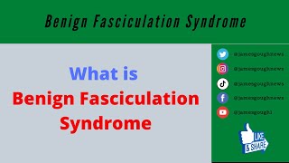 Amyotrophic Lateral Sclerosis Fasciculation AminampShwani 2010 [upl. by Myron]