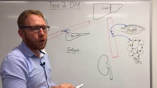 Type 2 Diabetes Pathophysiology [upl. by Norvun]