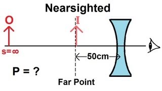 Physics  Optics Vision Correction 2 of 5 Nearsighted [upl. by Daraj395]