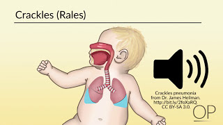 Respiratory Assessment by B Leary L DelSignore  OPENPediatrics [upl. by Arihaz]