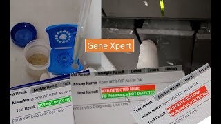 GeneXpert introduction procedure and its application [upl. by Tyler341]