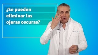 ¿Se pueden eliminar las ojeras oscuras  Corpore Sano [upl. by Ihcego]