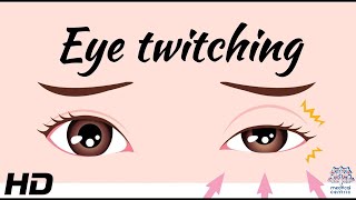 The Science Behind Eyelid Twitching Explained [upl. by Llewkcor]