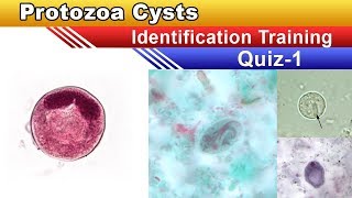 Protozoa Cysts Identification Training Quiz  Part 1 [upl. by Esereht200]