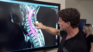 Symptoms of Cervical Stenosis  Jeffrey Cantor MD [upl. by Neirol]