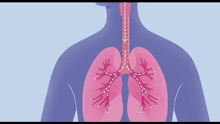 Lung Cancer Signs and Symptoms [upl. by Ycak94]