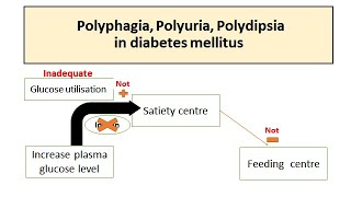 Polyuria Polyphagia Polydipsia in Diabetes mellitus [upl. by Iona]