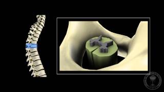 2Minute Neuroscience Corticospinal Tract [upl. by Anihcak]