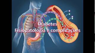 Diabetes  Fisiopatologia e complicações PARTE 01  Introdução [upl. by Asiela]